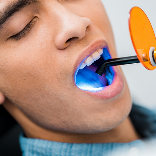 Close up of a dental patient having an ultraviolet light applied to his tooth