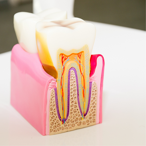 Model of a tooth on a desk showing the layers inside of it